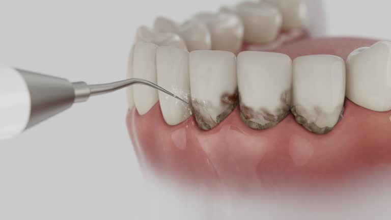 Trusted Dental Implants service in Coats, NC - Dentist Open Now